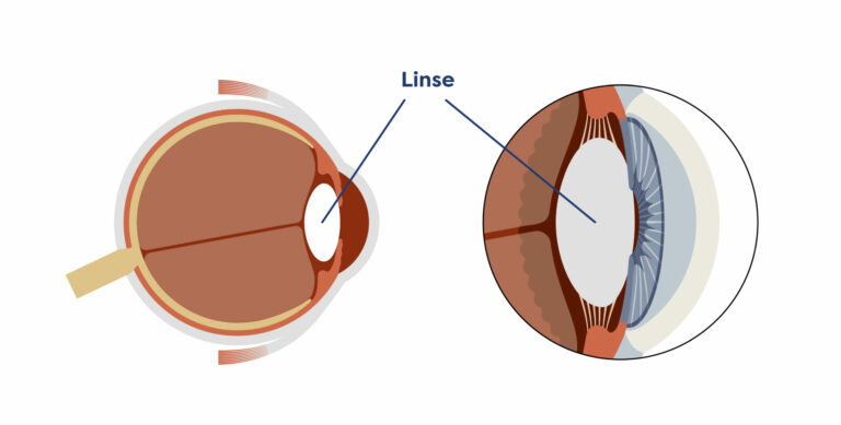 Illustration der Augenlinse im Querschnitt
