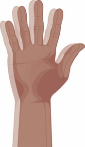 Illustration einer einer Hand, die doppelt gesehen wird (Doppelbilder)